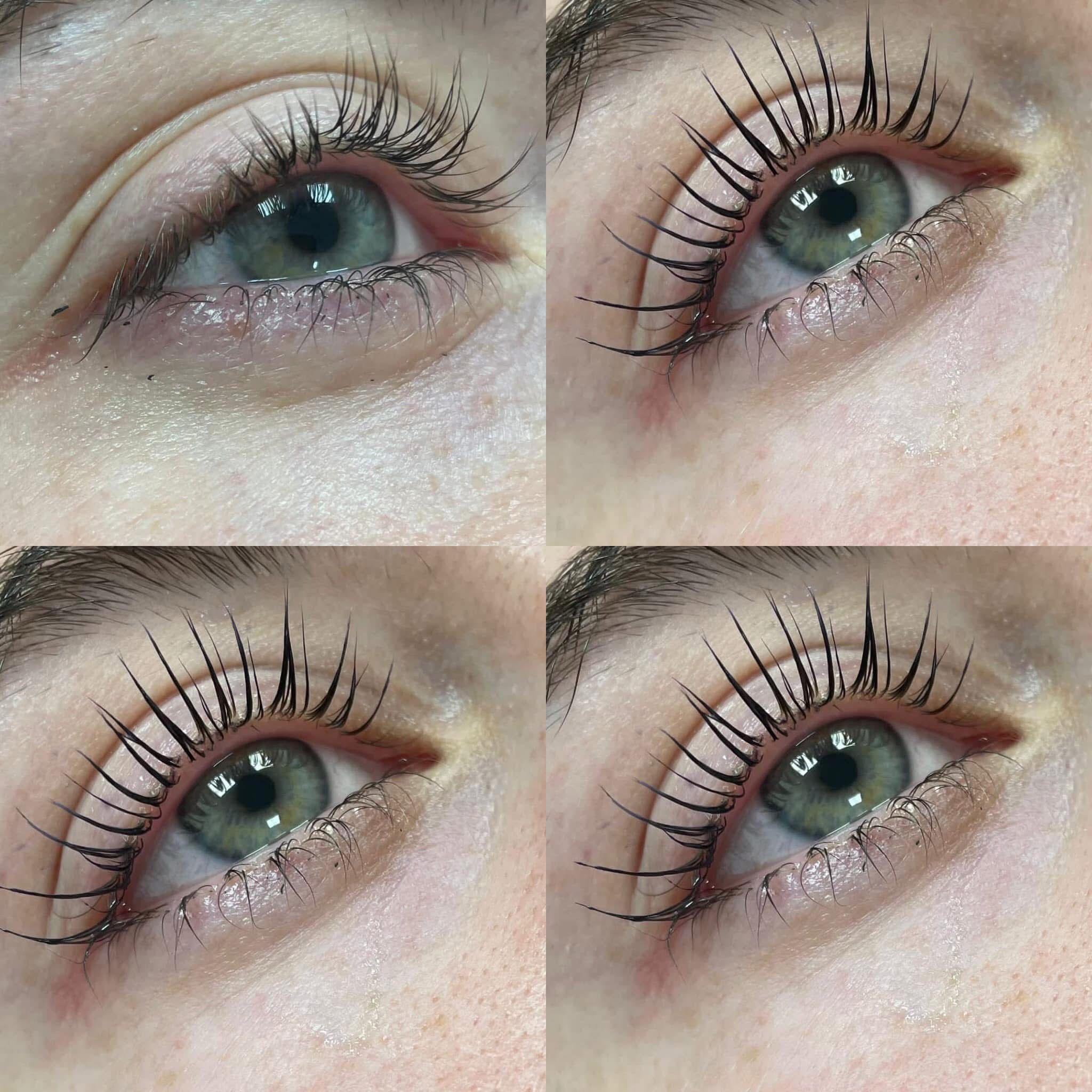 Eyes